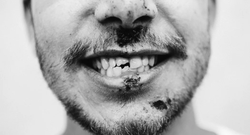 Black and white photo of the face of a young man, who is injured on the lips and under the nose, photographed by Michael Hinz.